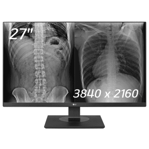 monitor lg 27inc 27hj713c b ips 8mp clinical negro 27hj713cb tcws 1.png